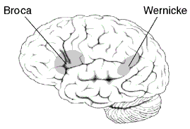 historique de la dyslexie broca wernicke